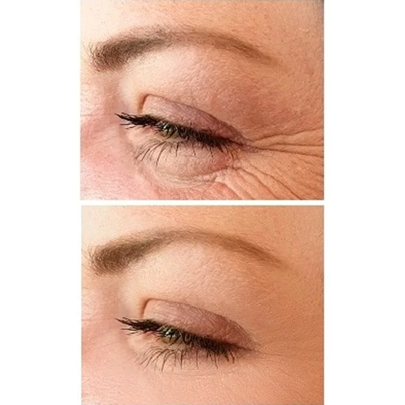 No.1 Lift Eye Cream 15 ml