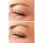 No.1 Lift Eye Cream 15 ml