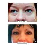 No.1 Lift Eye Cream 15 ml