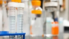 CRP hodnoty a jejich význam při diagnostice nemocí