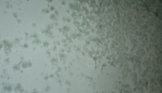 Efektivní metody, jak bojovat s plísní na zdi